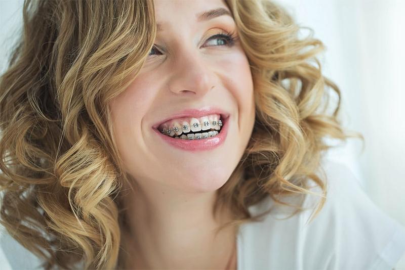 Μεταλλικά σιδεράκια θεραπεία - TK Orthodontics Αθήνα